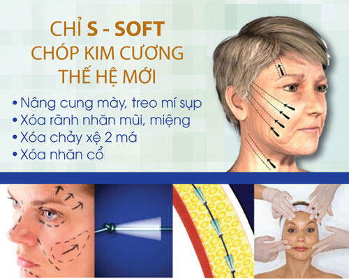 chi-s-soft-chop-kim-cuong